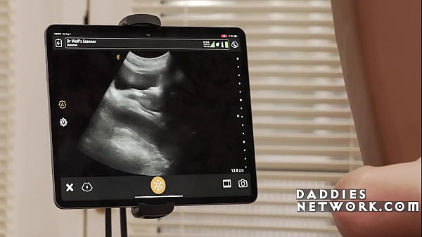 Doctor’s Special Anal Ultrasound Dickment – Raw Pounding